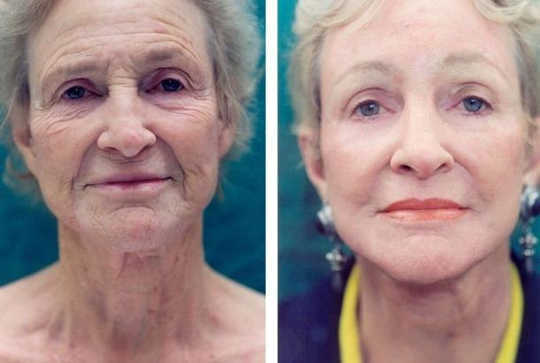 These Exercises Took 3 Years Off Of Aging Faces